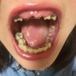 レス1番の画像サムネイル