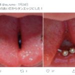 レス2番の画像サムネイル
